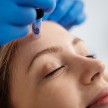 Upload image to gallery viewer, Facial Microneedling for Rejuvenation and Fine Wrinkles