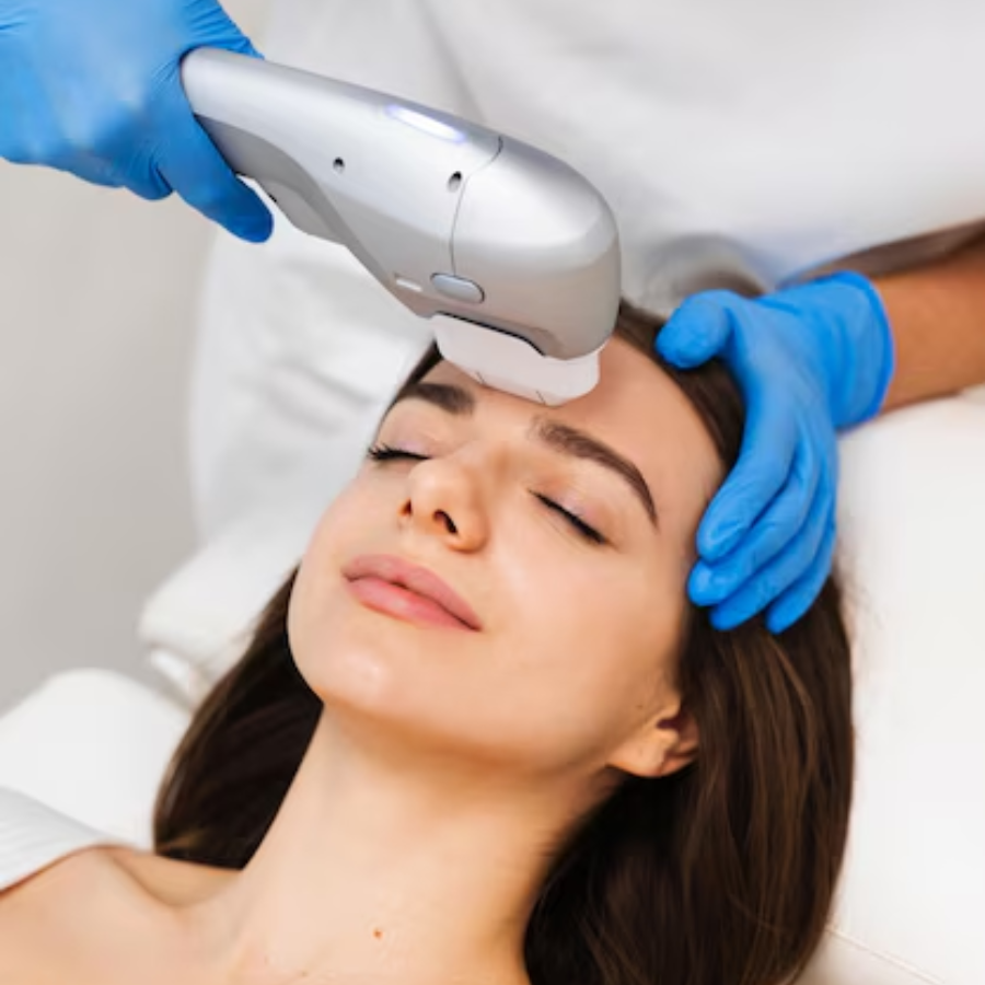 Ultraformer III Contorno facial e papada - Ultrassom microfocado