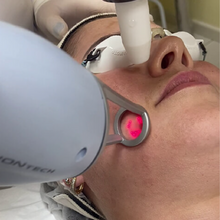 Upload image to gallery viewer, Lavieen Facial Laser for BB Glow Effect Thulium Full Face