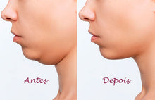 Upload image to gallery viewer, Enzyme Injection for Double Chin Reduction and Weight Loss
