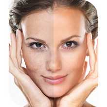 Upload image to gallery viewer, Lavieen Facial Laser for BB Glow Effect Thulium Full Face