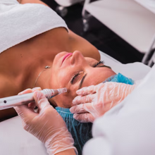 Upload image to gallery viewer, Facial Microneedling for Rejuvenation and Fine Wrinkles