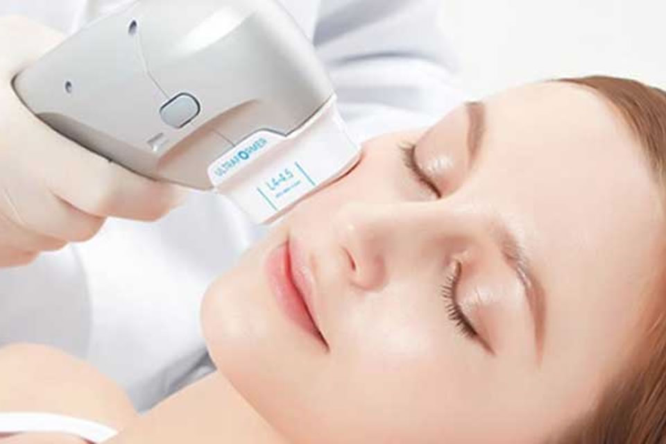 Ultraformer MPT Full face Rosto - Ultrassom microfocado