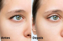 Carregar imagem no visualizador da galeria, Jato de Plasma Facial para Tratar Linhas Rugas e Cicatrizes de Acne