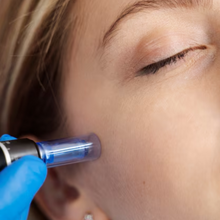 Upload image to gallery viewer, Facial Microneedling for Rejuvenation and Fine Wrinkles