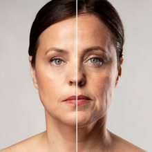 Upload image to gallery viewer, Lavieen Facial Laser for BB Glow Effect Thulium Full Face