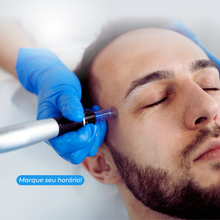Carregar imagem no visualizador da galeria, Microagulhamento Capilar para Queda de cabelos Tratamento