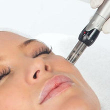 Upload image to gallery viewer, Facial Microneedling for Rejuvenation and Fine Wrinkles
