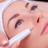 Carregar imagem no visualizador da galeria, Jato de Plasma Facial para Tratar Linhas Rugas e Cicatrizes de Acne