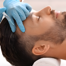 Carregar imagem no visualizador da galeria, Injeção de Enzimas para Queda de Cabelo