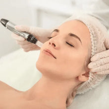 Upload image to gallery viewer, Microneedling for Scars and Acne Marks Facial Dermapen