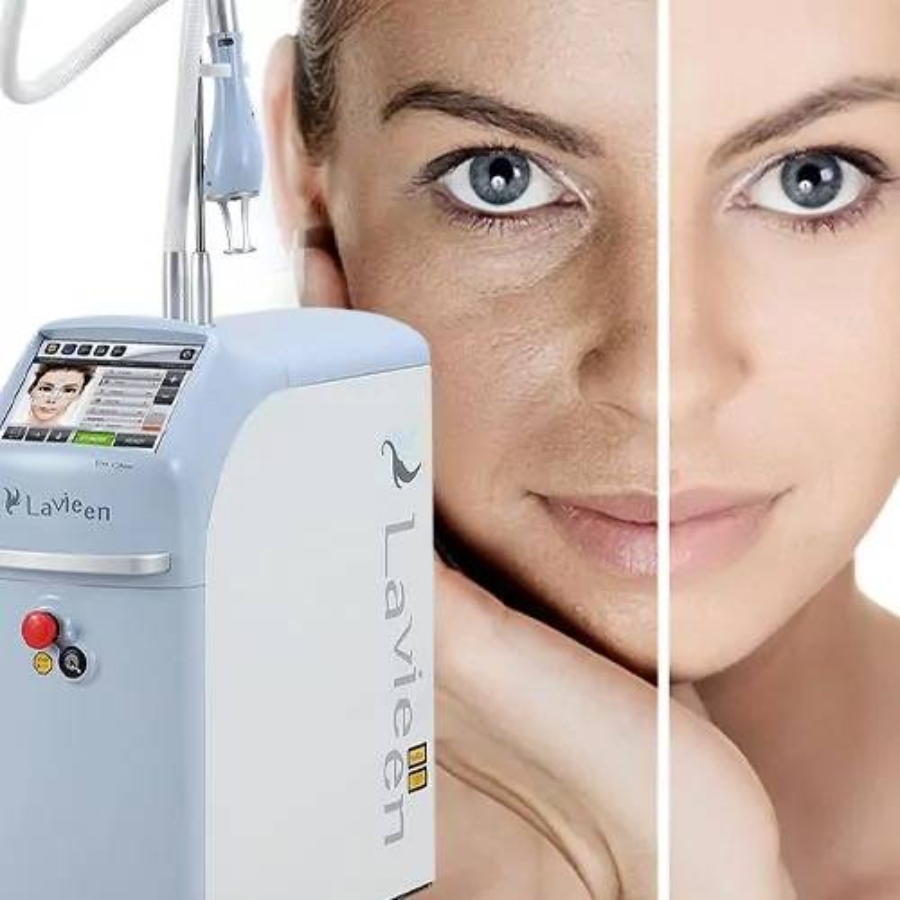 Laser Lavieen: Tudo que Você Precisa Saber