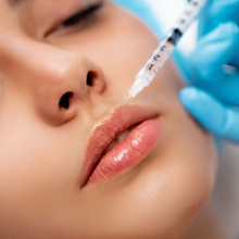 Upload image to gallery viewer, Lip Filling with Hyaluronic Acid
