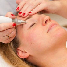 Carregar imagem no visualizador da galeria, Jato de Plasma Facial para Tratar Linhas Rugas e Cicatrizes de Acne
