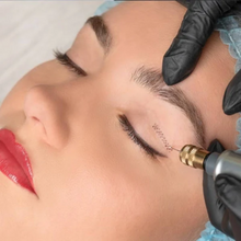 Carregar imagem no visualizador da galeria, Blefaroplastia sem Cortes com Jato de Plasma Lifting De Pálpebras
