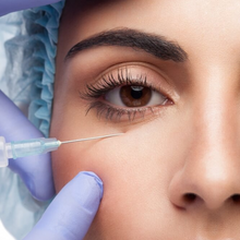 Carregar imagem no visualizador da galeria, Botox Toxina Botulínica para Testa Olhos e Glabela Allergan
