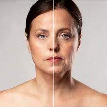 Carregar imagem no visualizador da galeria, Botox Toxina Botulínica para Testa Olhos e Glabela Allergan
