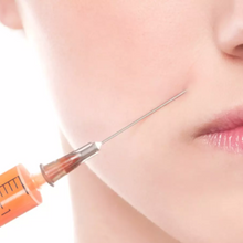 Carregar imagem no visualizador da galeria, Botox Toxina Botulínica para Testa Olhos e Glabela Allergan
