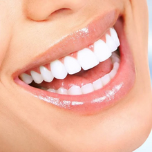 Upload image to gallery viewer, Gummy Smile Botulinum Toxin Botox
