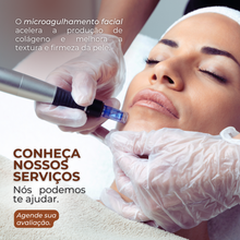 Carregar imagem no visualizador da galeria, Microagulhamento Capilar para Queda de cabelos Tratamento
