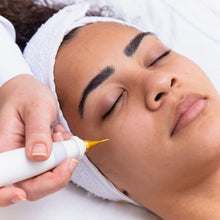 Carregar imagem no visualizador da galeria, Jato de Plasma Facial para Tratar Linhas Rugas e Cicatrizes de Acne
