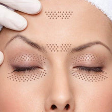 Carregar imagem no visualizador da galeria, Jato de Plasma Facial para Tratar Linhas Rugas e Cicatrizes de Acne
