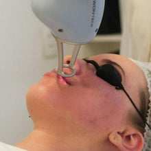 Upload image to gallery viewer, Lavieen Laser Acne Scar Treatment with Active Ingredients
