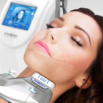 Ultraformer III Contorno facial e papada - Ultrassom microfocado